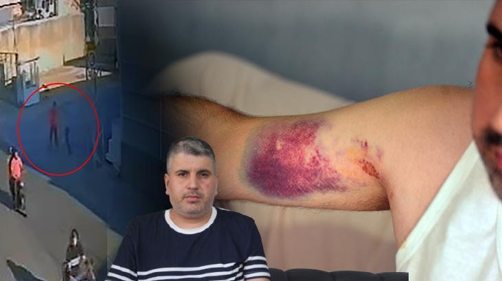 dededen kalan miras hayatini karartti artik arkama baka baka gidiyorum hveFhRX8