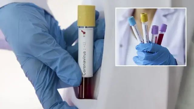 zayiflar kovid 19u daha agir geciriyor 1nHrTWfe.webp